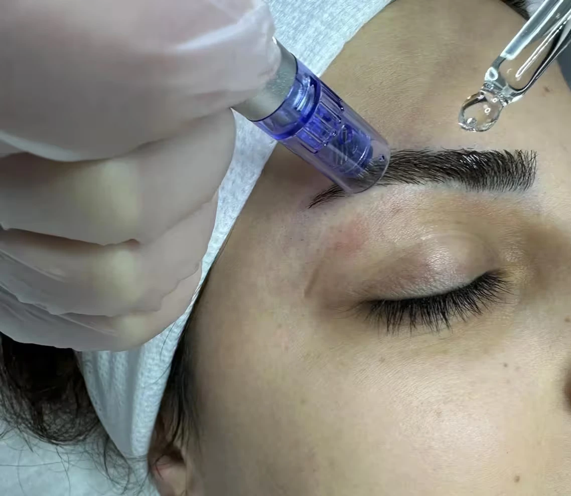 Kaş Vitamini Hizmetimiz